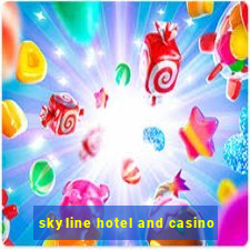 skyline hotel and casino