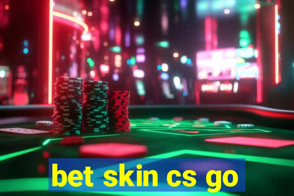 bet skin cs go