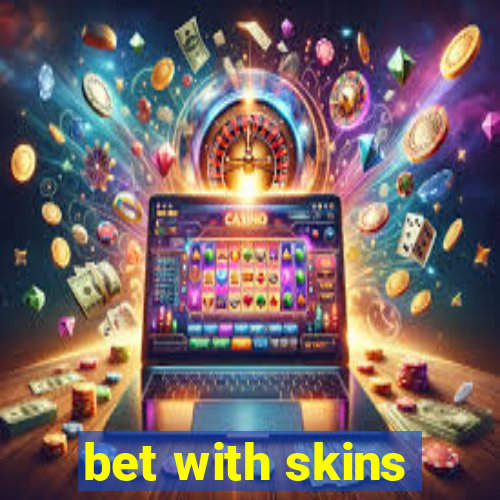 bet with skins