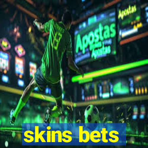 skins bets